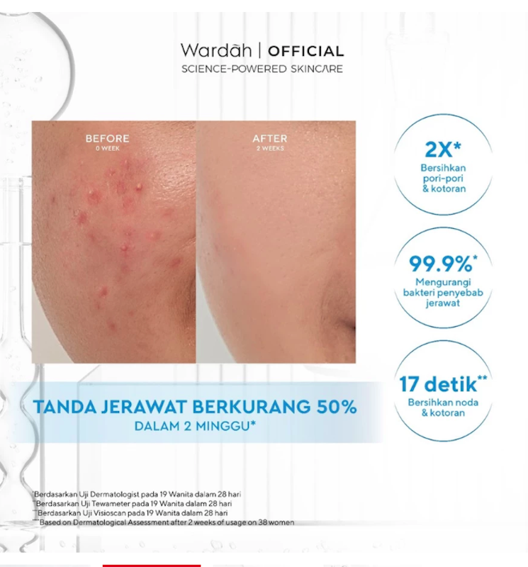 Wardah | Acnederm Acne Care Micellar Water