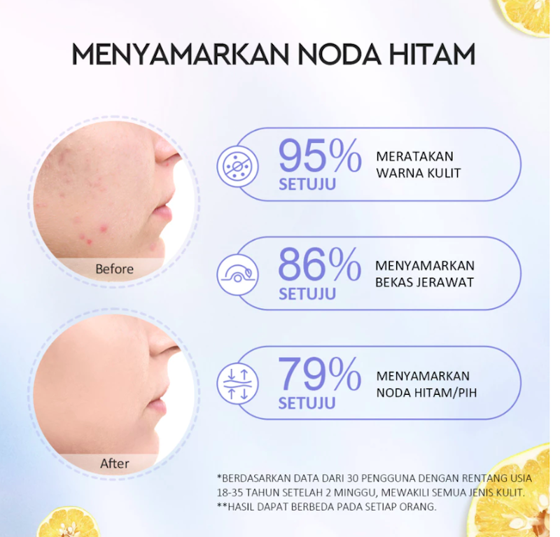 Glad2Glow Yuja Symwhite 377 Dark Spot Moisturizer