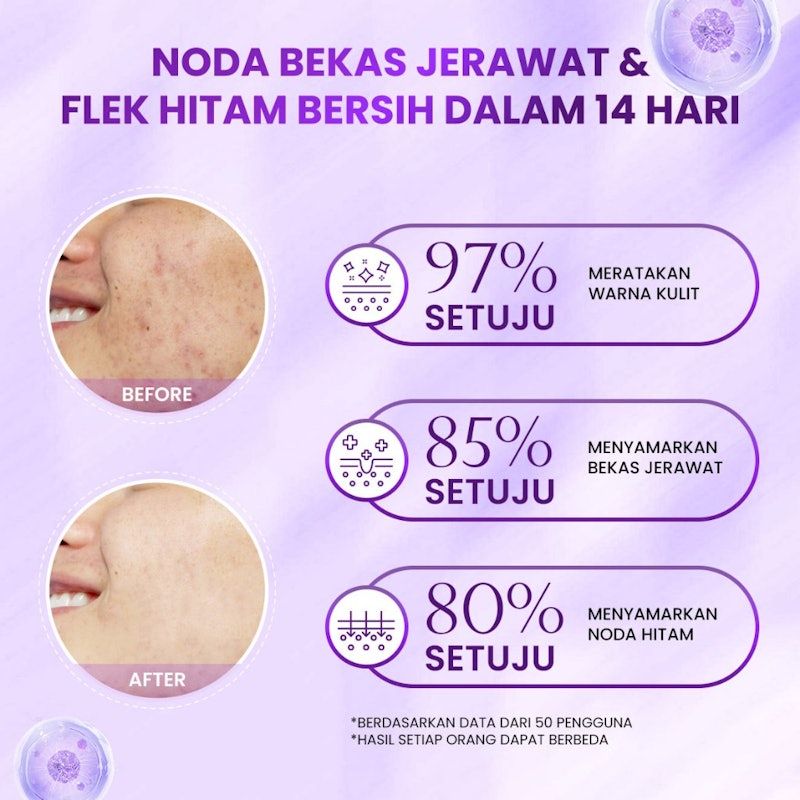 Animate Miraculous Dark Spot Overnight Cream