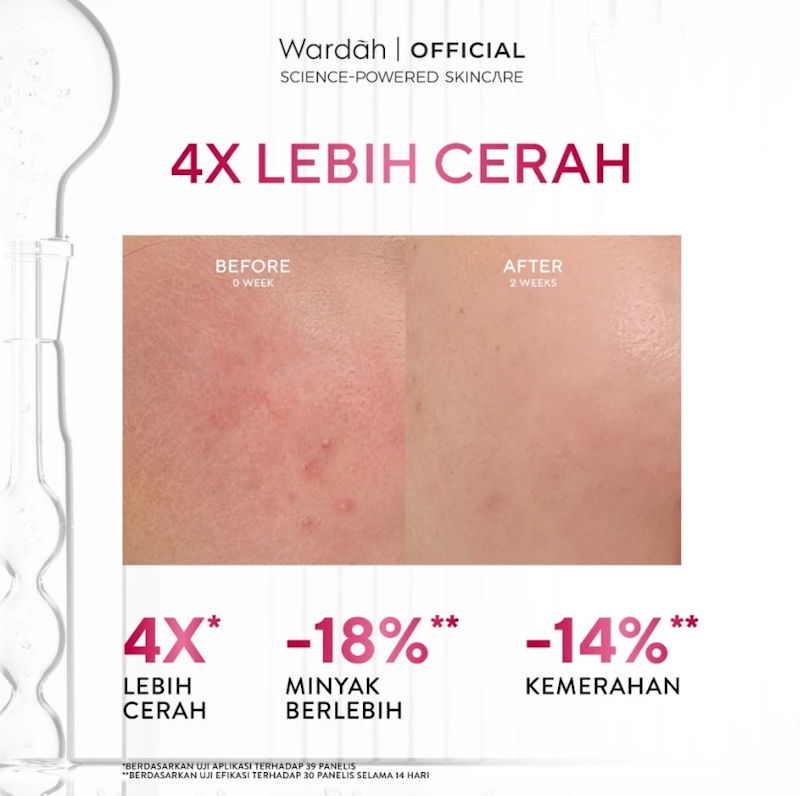 Wardah | PERFECT BRIGHT Bright+Tone Up Micellar Water