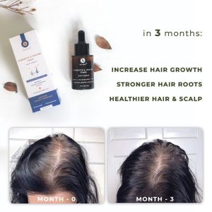 Eucalie Hair Growth Anti Hair Fall Tonic Organic Serum Strength & Volume