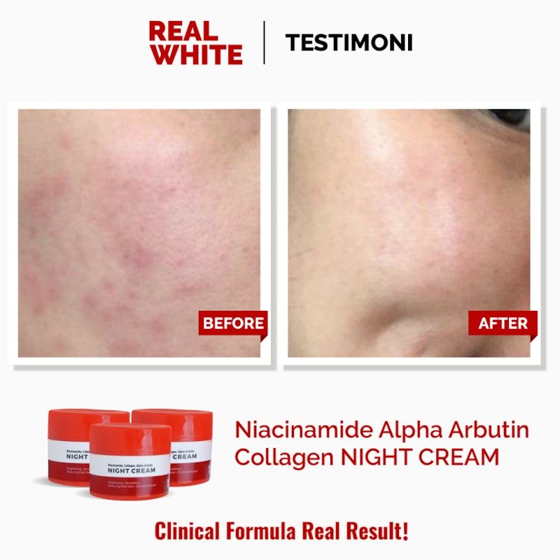 Niacinamide Alpha Arbutin Collagen Night Cream