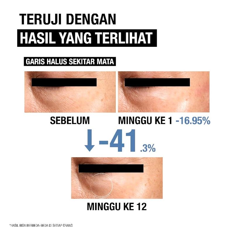 Neutrogena® | Visible Repair Eye Cream