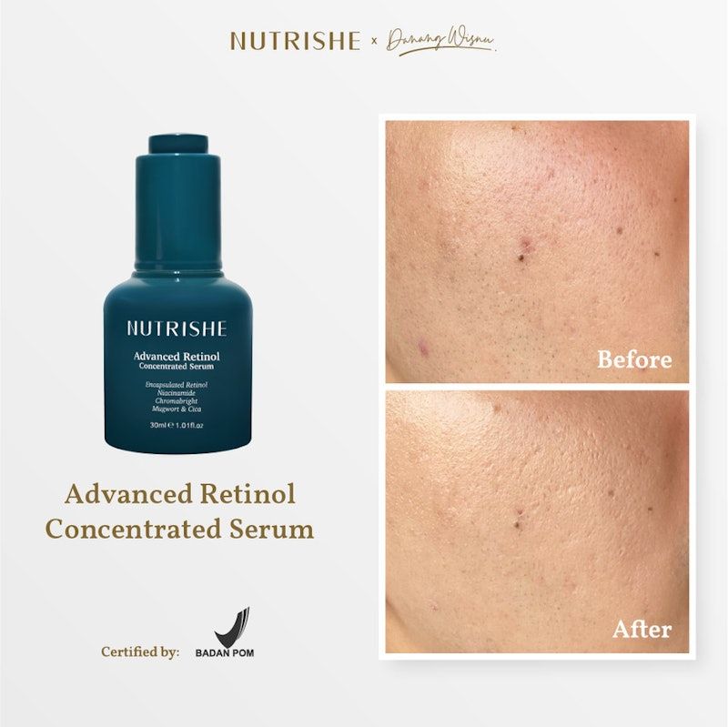 Nutrishe Advanced Retinol Concentrated Serum