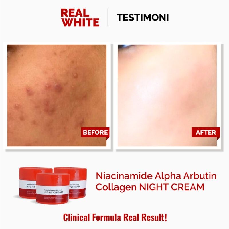 Niacinamide Alpha Arbutin Collagen Night Cream