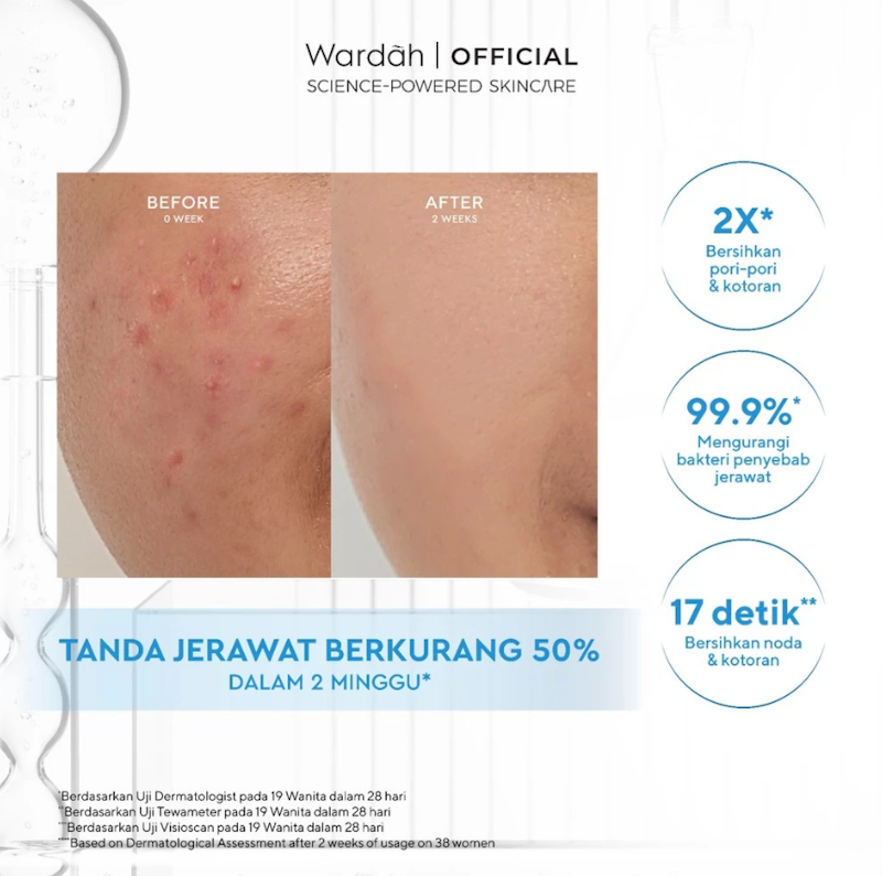 Wardah | Acnederm Acne Care Micellar Water