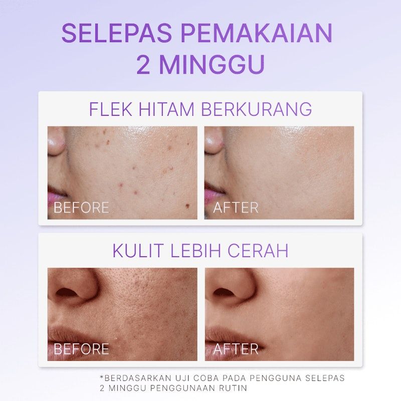 Ozzaskin Anti Dark Spot Night Cream