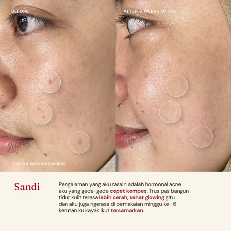 For Skin's Sake Retinol Cream 0.1%