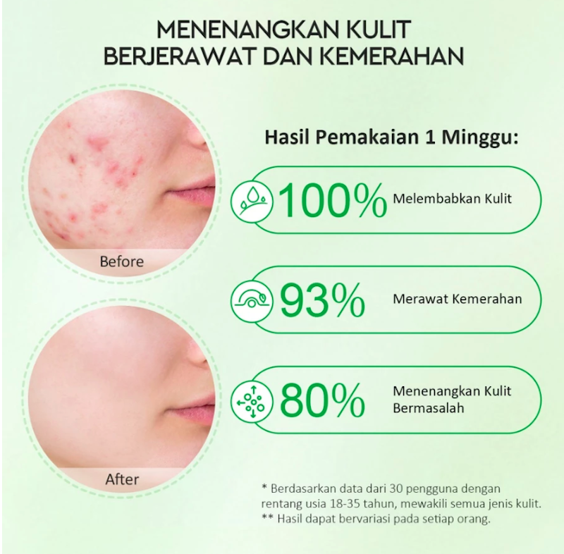 Glad2Glow Centella Allantoin Soothing Gel Moisturizer
